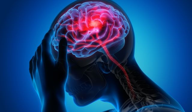 Epilepsi (Sara) krizinde ne yapmalı?